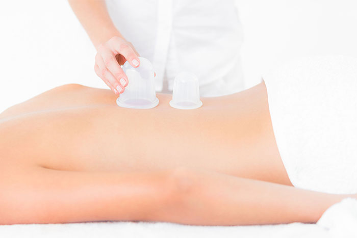 Myofascial Cupping Massage