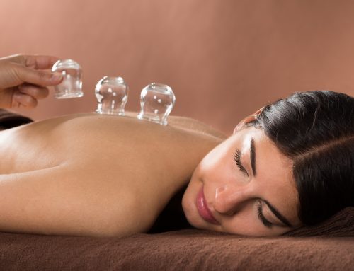 A Quick Guide to Cupping Therapy